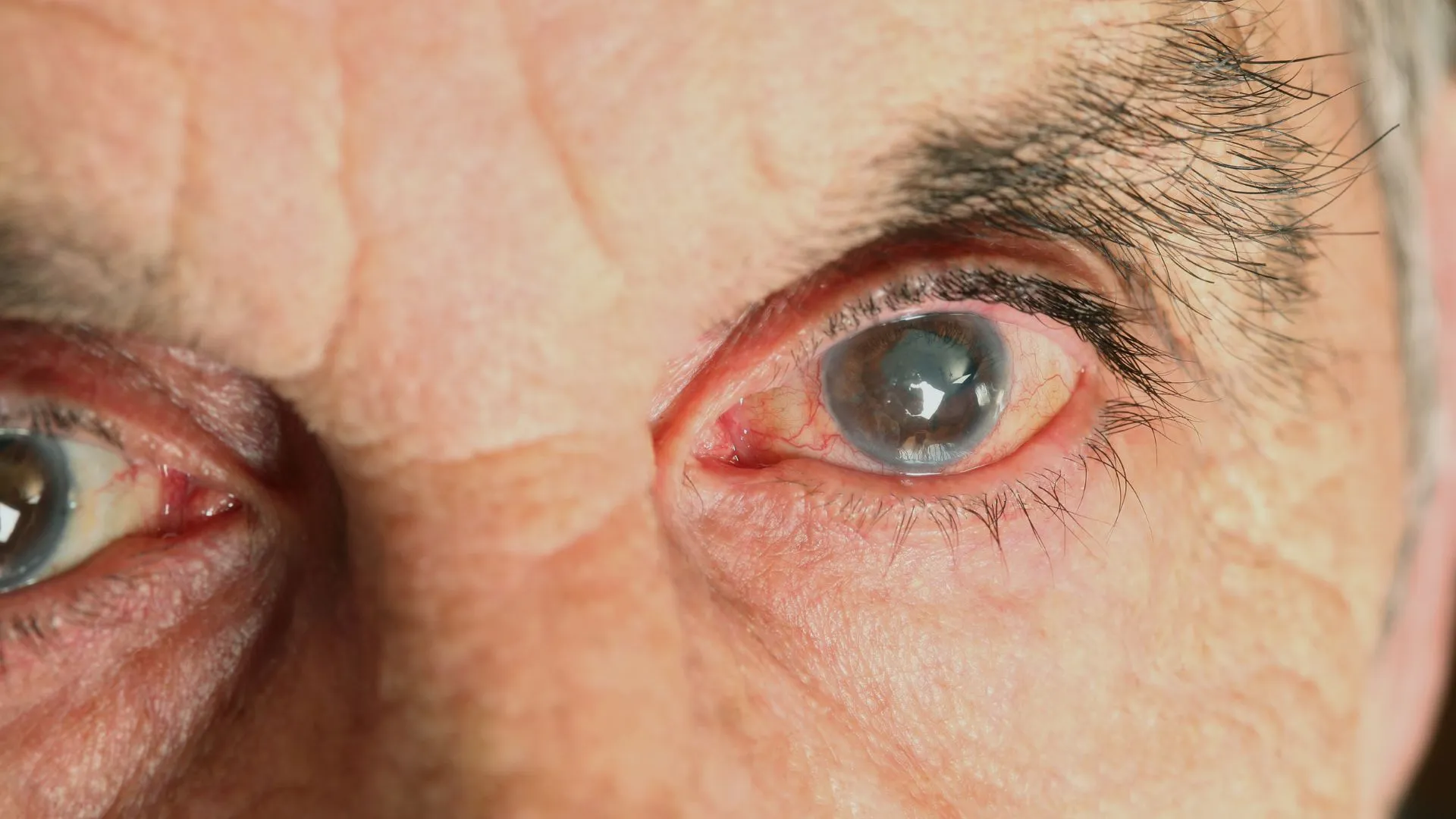 Pathologies de l’oeil et soins - cabinet ophtalmologue Dr Laurent Périn